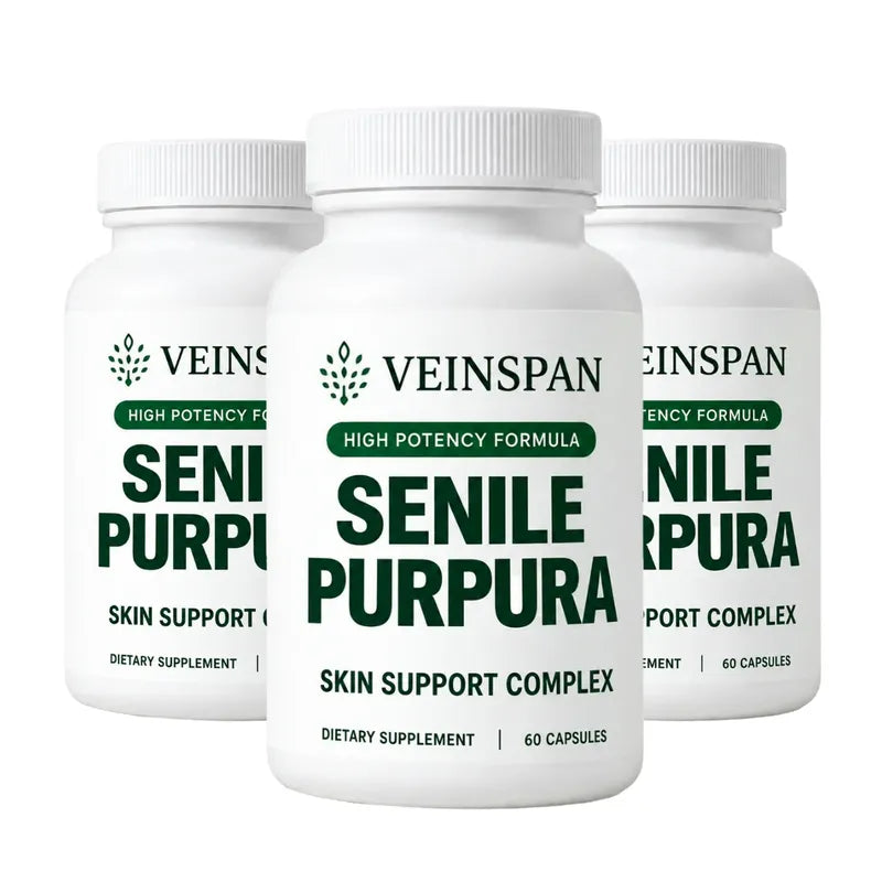 Veinspan
