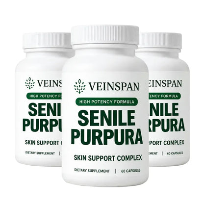 Veinspan